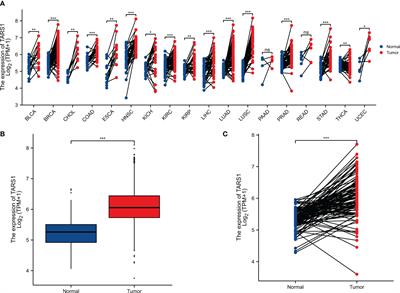 Clinical implications and immune implications features of TARS1 in breast cancer